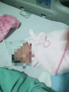 Negligencia en IMSS de Papantla pone en riesgo vida de recién nacida