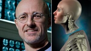 Trasplantes de cabeza 22 X 25