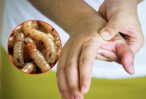 Veracruz confirma 8 casos de gusano barrenador en humanos