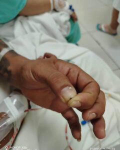 Reportan presunta garrapata en Clínica 71 del IMSS